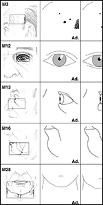 Tabellarische Gegenüberstellung von Befunden